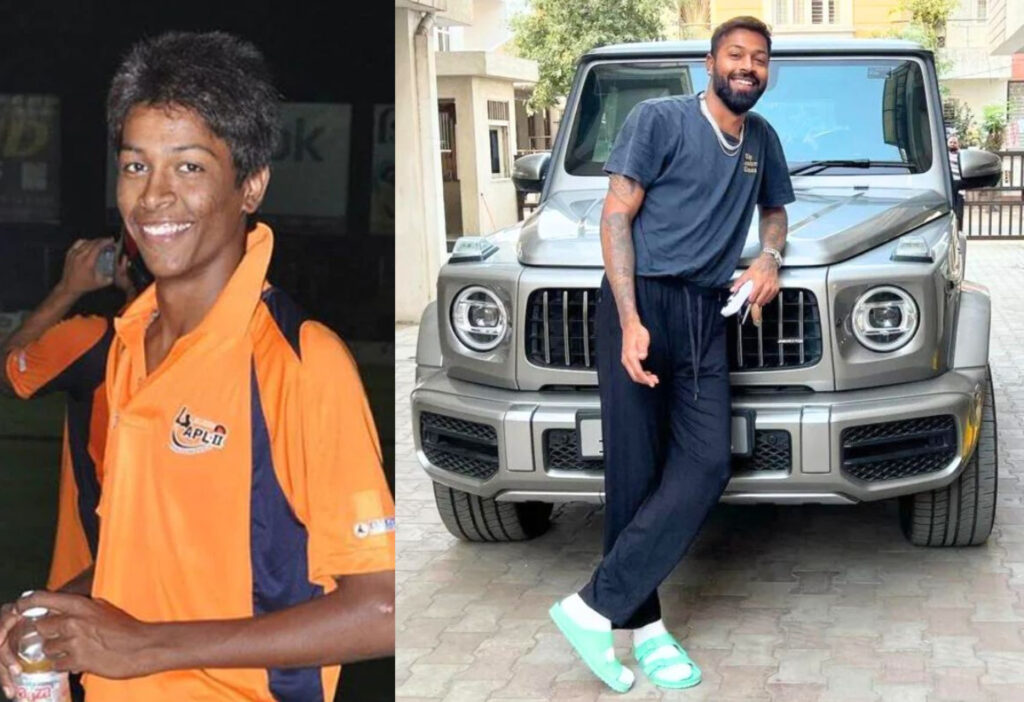 Hardik Pandya – Before and After Success